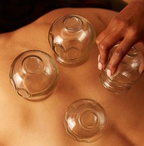 كاسات الهواء (الحجامة الجافة)