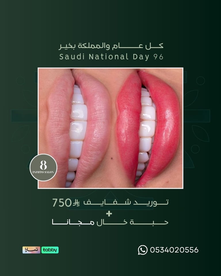 توريد شفايف + حبة خال مجانا 