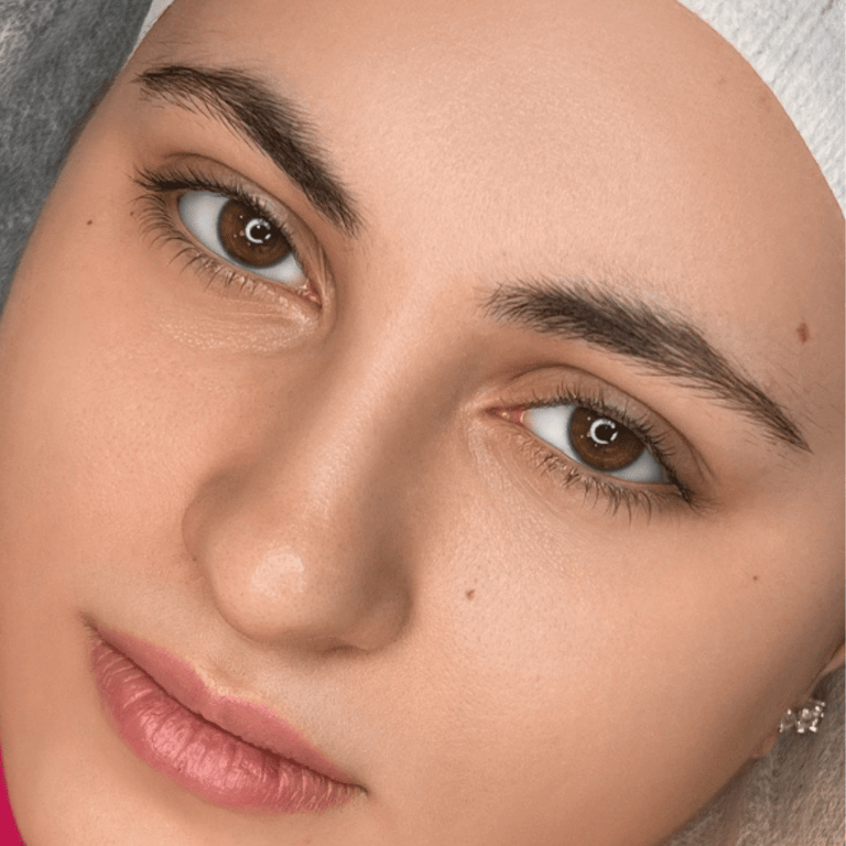  تركش