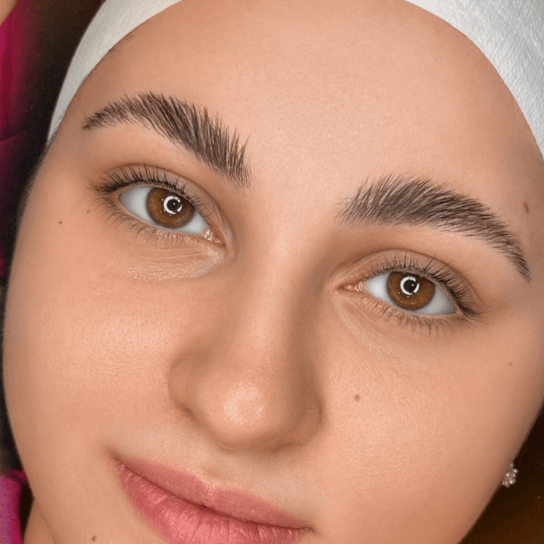  تركش