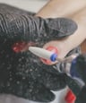Extension Removal