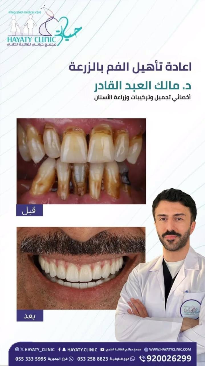 كشفية دكتور مالك العبدالقادر