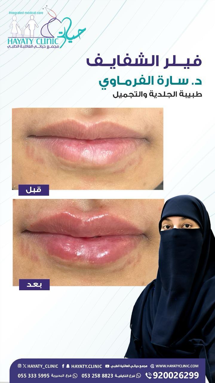 كشفية دكتوره ساره الفرماوي