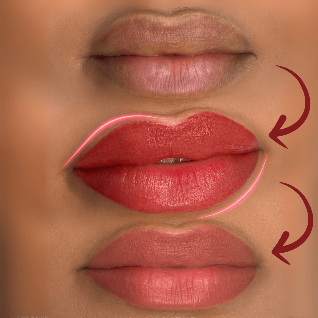 توريد الشفاه