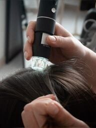 تنظيف وإزالة ترسبات فروة الرأس